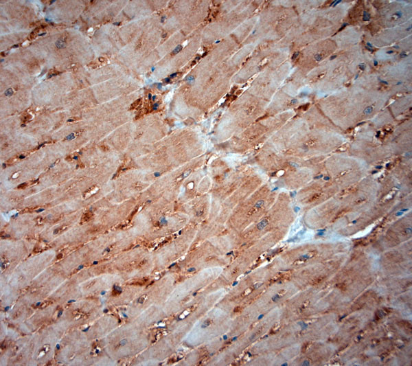 ATG4D Antibody in Immunohistochemistry (Paraffin) (IHC (P))