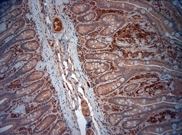 ATG4D Antibody in Immunohistochemistry (Paraffin) (IHC (P))