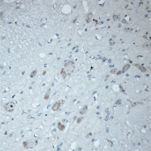 ATG16L1 Antibody in Immunohistochemistry (Paraffin) (IHC (P))