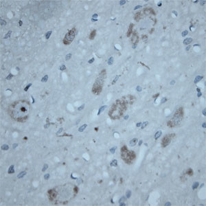 ATG16L1 Antibody in Immunohistochemistry (Paraffin) (IHC (P))