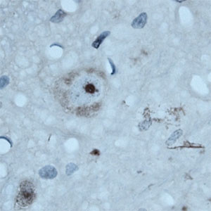 ATG16L1 Antibody in Immunohistochemistry (Paraffin) (IHC (P))