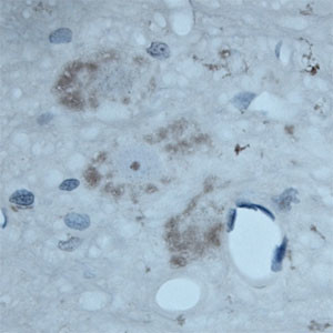 ATG16L1 Antibody in Immunohistochemistry (Paraffin) (IHC (P))