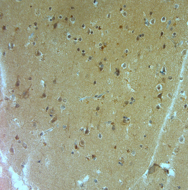 APP Antibody in Immunohistochemistry (Paraffin) (IHC (P))