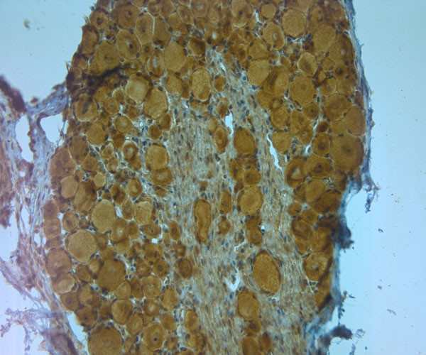 APP Antibody in Immunohistochemistry (Paraffin) (IHC (P))