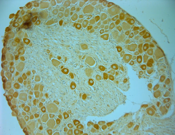 AKT Antibody in Immunohistochemistry (Paraffin) (IHC (P))