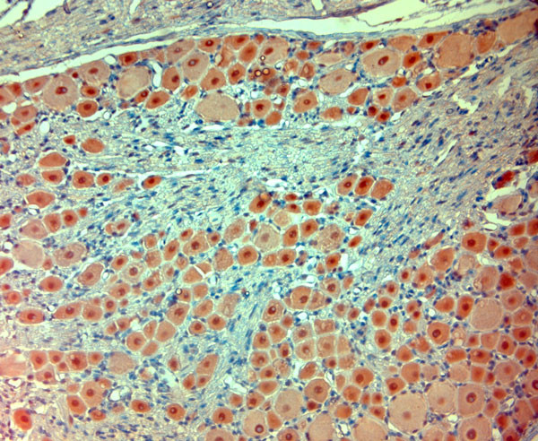 extracellular ASIC1 Antibody in Immunohistochemistry (Paraffin) (IHC (P))