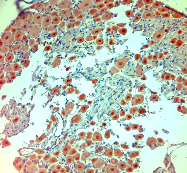 extracellular ASIC1 Antibody in Immunohistochemistry (Paraffin) (IHC (P))