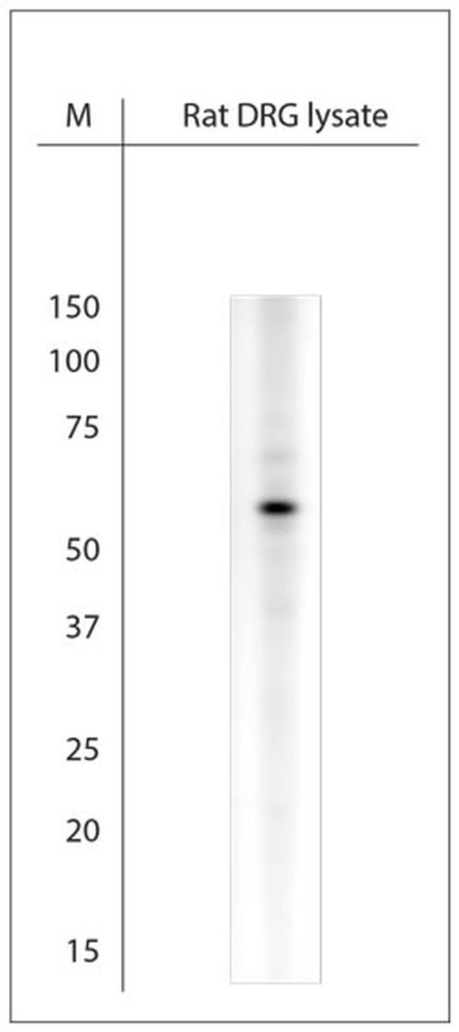 extracellular ASIC1 Antibody in Western Blot (WB)