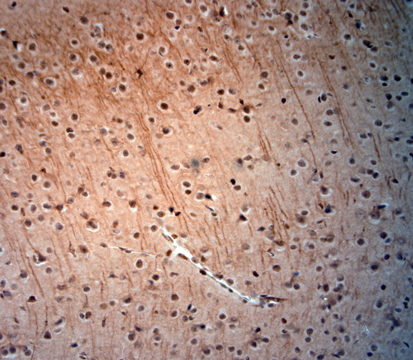 extracellular ASIC3 Antibody in Immunohistochemistry (Paraffin) (IHC (P))