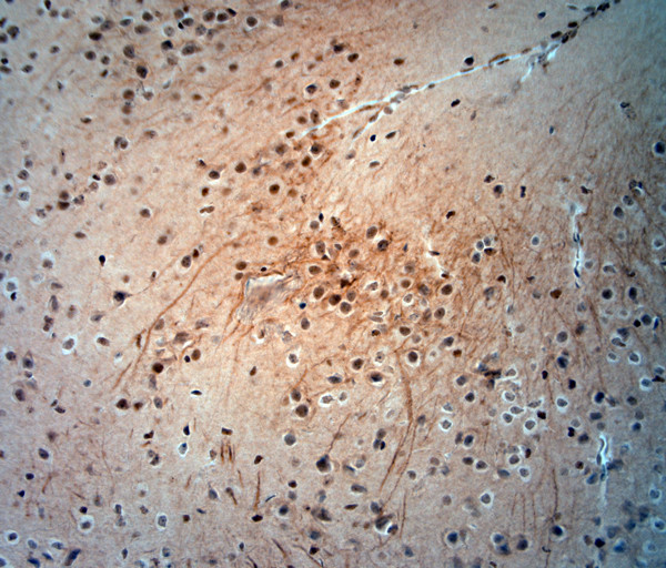 extracellular ASIC3 Antibody in Immunohistochemistry (Paraffin) (IHC (P))