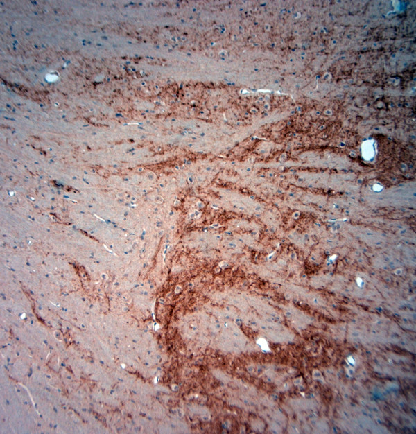 extracellular ASIC3 Antibody in Immunohistochemistry (Paraffin) (IHC (P))