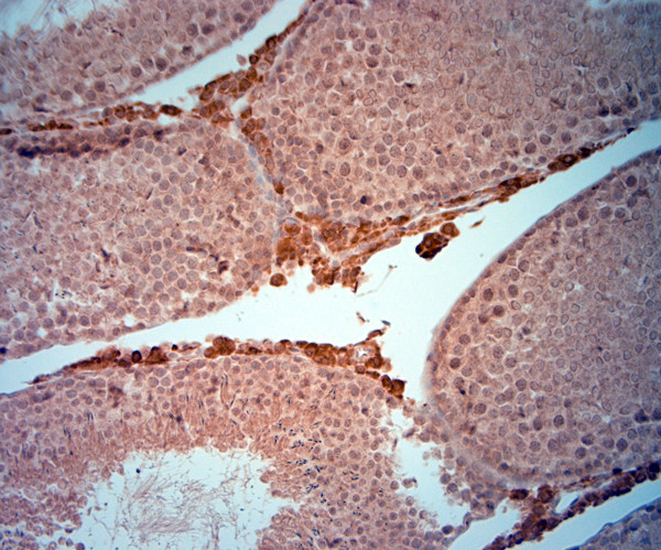 AQP2 Antibody in Immunohistochemistry (Paraffin) (IHC (P))