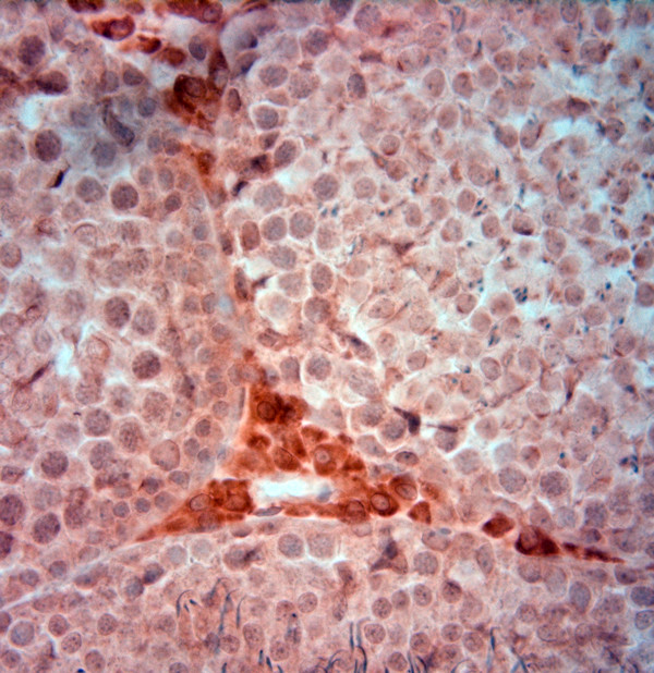 AQP2 Antibody in Immunohistochemistry (Paraffin) (IHC (P))