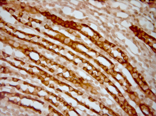 AQP2 Antibody in Immunohistochemistry (Paraffin) (IHC (P))