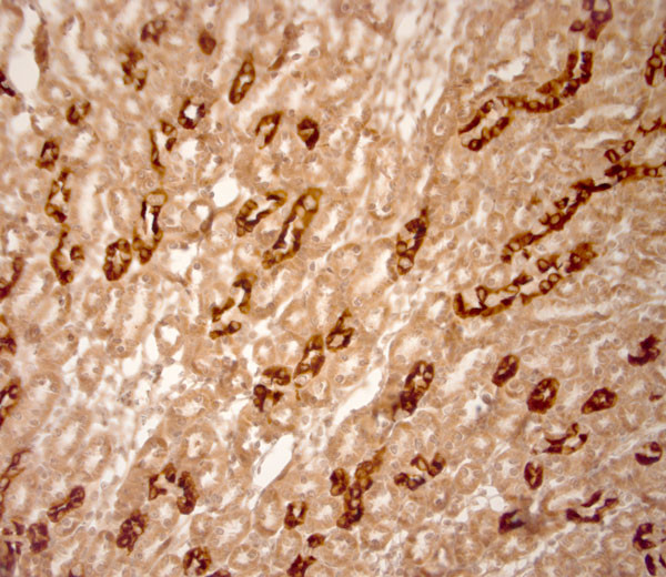 AQP2 Antibody in Immunohistochemistry (Paraffin) (IHC (P))