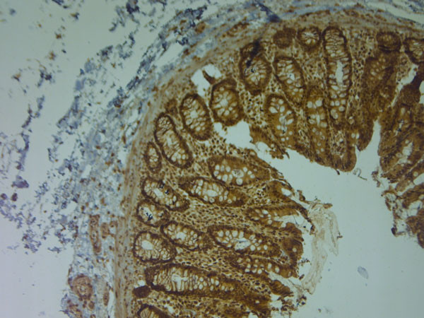 AQP9 Antibody in Immunohistochemistry (Paraffin) (IHC (P))