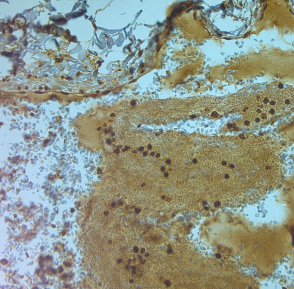 AQP9 Antibody in Immunohistochemistry (Paraffin) (IHC (P))