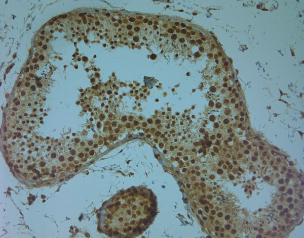 AQP9 Antibody in Immunohistochemistry (Paraffin) (IHC (P))