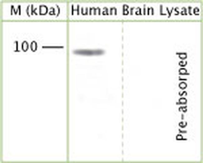 Amyloid beta precursor protein Antibody in Western Blot (WB)