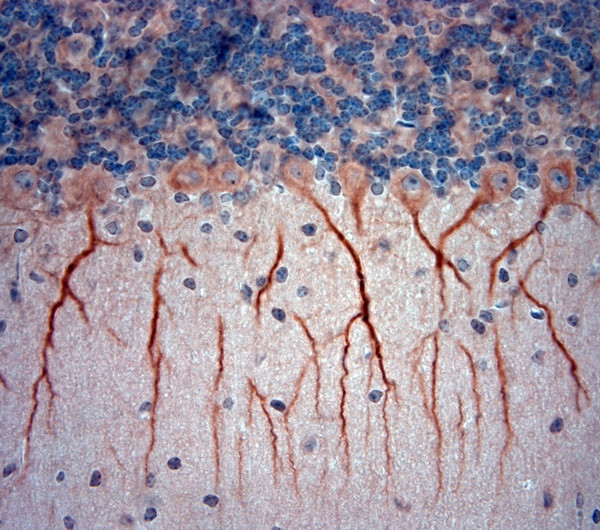 ATP5A1 Antibody in Immunohistochemistry (Paraffin) (IHC (P))