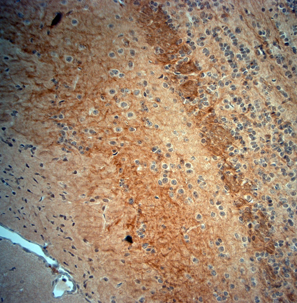 ATP5A1 Antibody in Immunohistochemistry (Paraffin) (IHC (P))