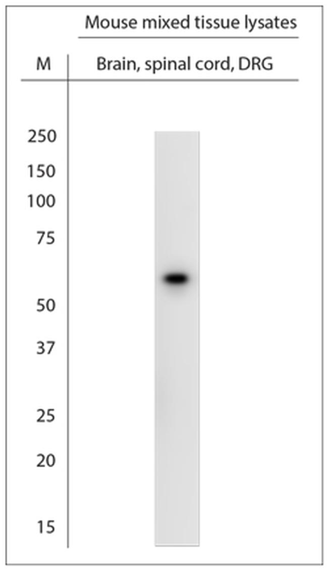 ATP5A1 Antibody in Western Blot (WB)