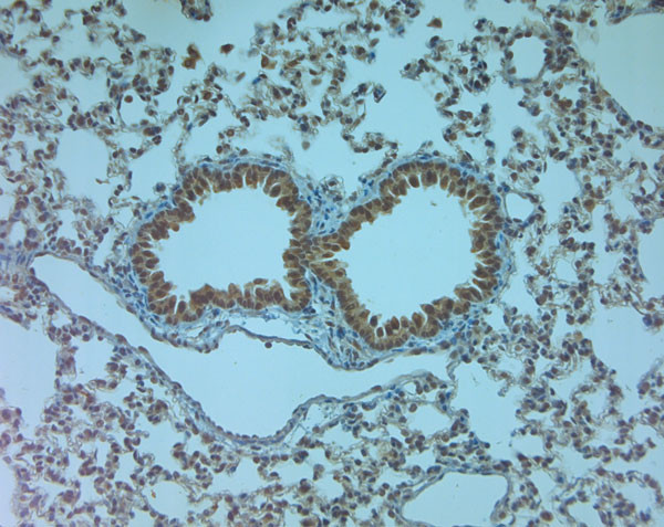 AQP9 Antibody in Immunohistochemistry (IHC)