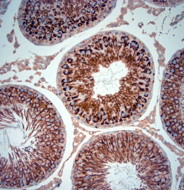 Artemin Antibody in Immunohistochemistry (Paraffin) (IHC (P))