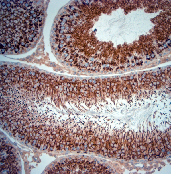 Artemin Antibody in Immunohistochemistry (Paraffin) (IHC (P))