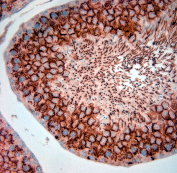 Artemin Antibody in Immunohistochemistry (Paraffin) (IHC (P))