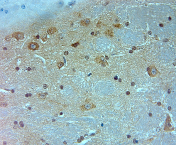 Ankyrin G Antibody in Immunohistochemistry (IHC)