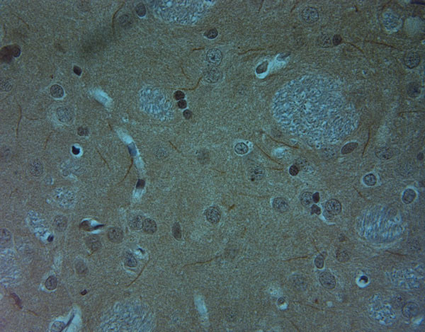 Ankyrin G Antibody in Immunohistochemistry (IHC)