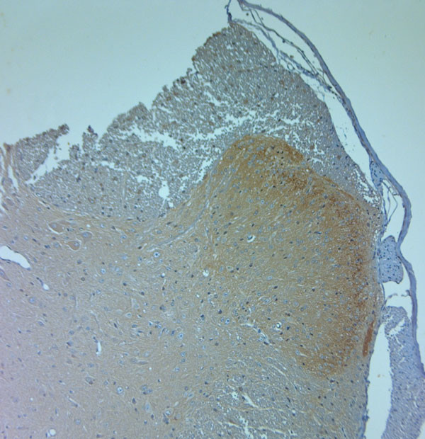 Ankyrin G Antibody in Immunohistochemistry (IHC)