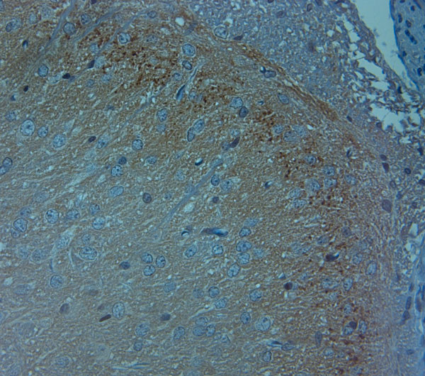 Ankyrin G Antibody in Immunohistochemistry (IHC)