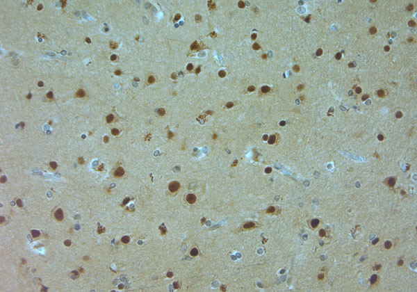 AQP9 Antibody in Immunohistochemistry (Paraffin) (IHC (P))