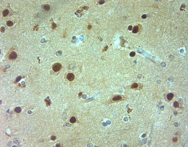 AQP9 Antibody in Immunohistochemistry (Paraffin) (IHC (P))