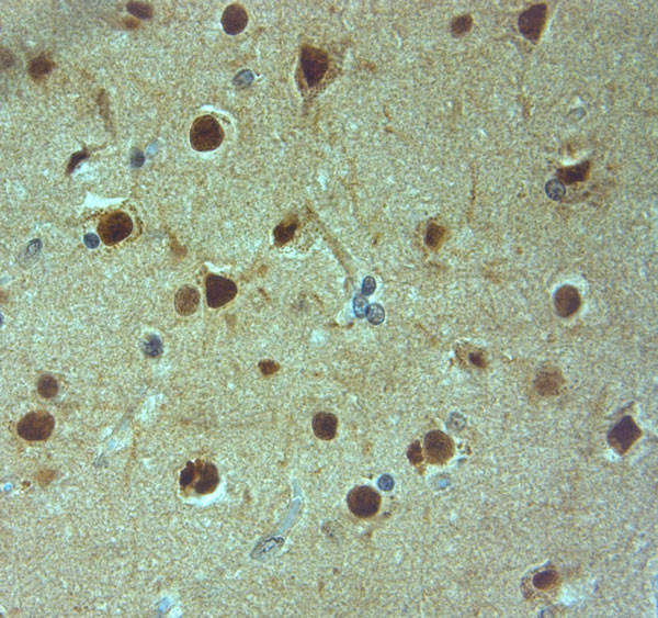 AQP9 Antibody in Immunohistochemistry (Paraffin) (IHC (P))