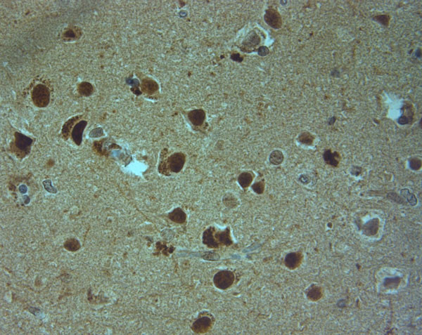 AQP9 Antibody in Immunohistochemistry (Paraffin) (IHC (P))