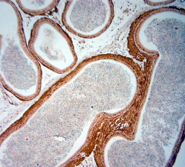 AQP4 Antibody in Immunohistochemistry (Paraffin) (IHC (P))