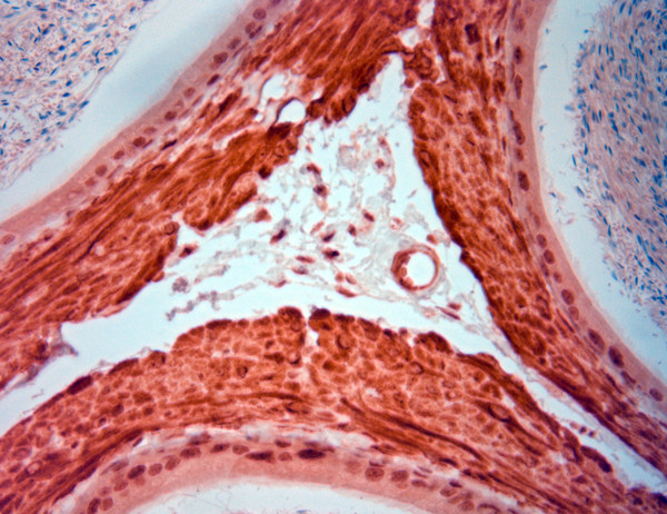 AQP4 Antibody in Immunohistochemistry (Paraffin) (IHC (P))