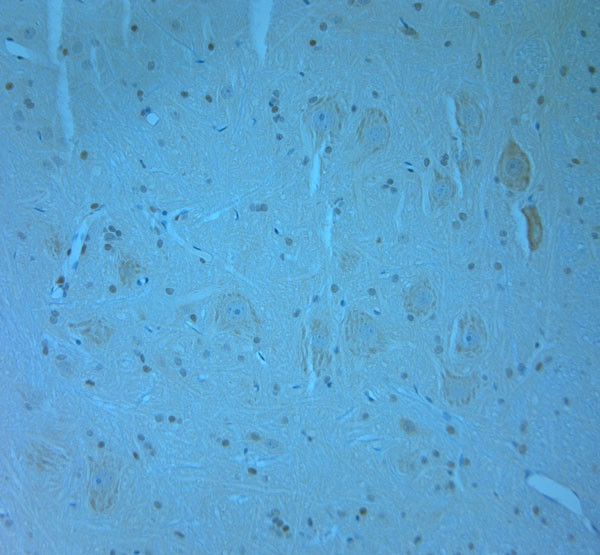 WDFY3 Antibody in Immunohistochemistry (Paraffin) (IHC (P))