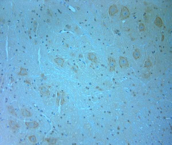 AIP1 Antibody in Immunohistochemistry (Paraffin) (IHC (P))