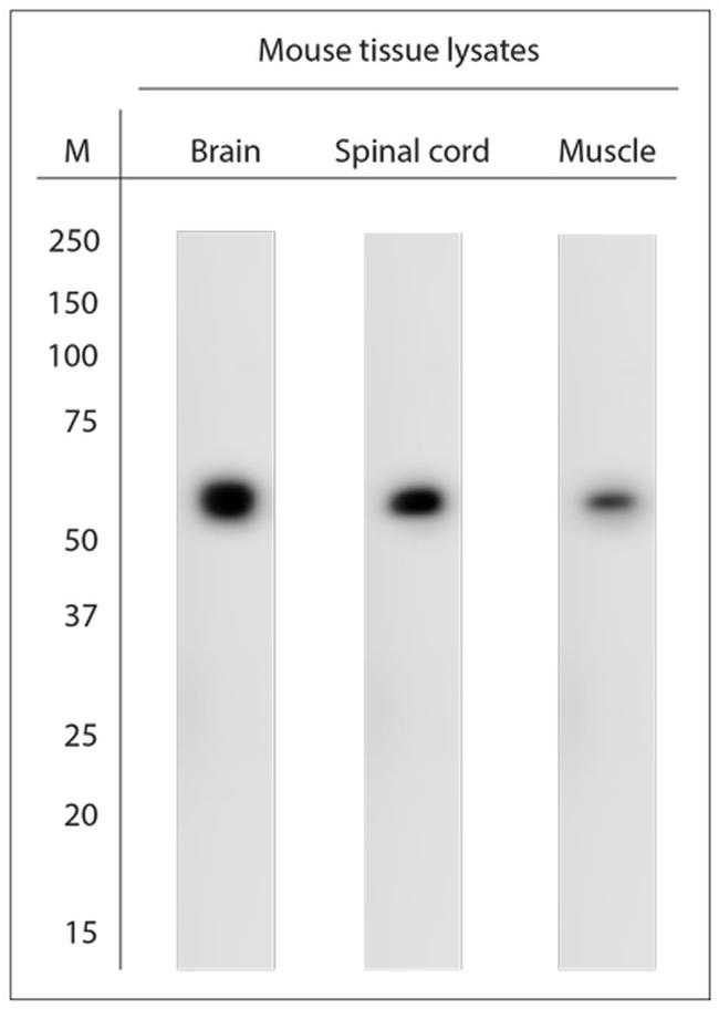 Atlastin 2 Antibody in Western Blot (WB)