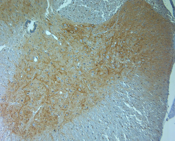 Aggrecan Antibody in Immunohistochemistry (Paraffin) (IHC (P))