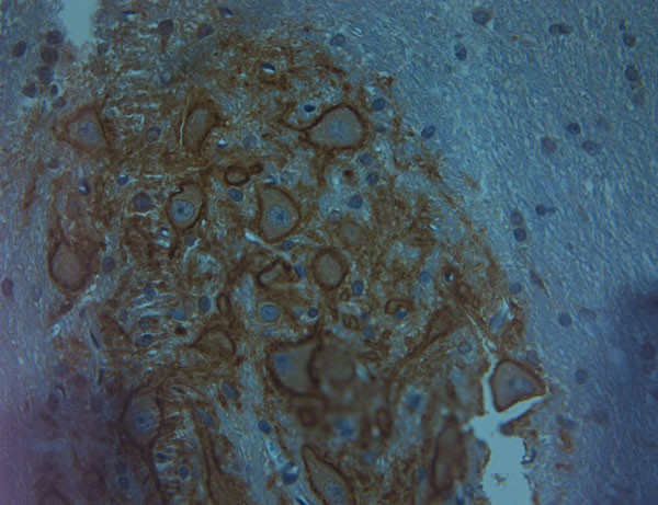 Aggrecan Antibody in Immunohistochemistry (Paraffin) (IHC (P))