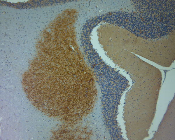 Aggrecan Antibody in Immunohistochemistry (Paraffin) (IHC (P))