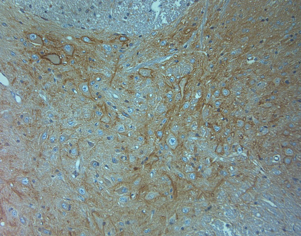 Aggrecan Antibody in Immunohistochemistry (Paraffin) (IHC (P))