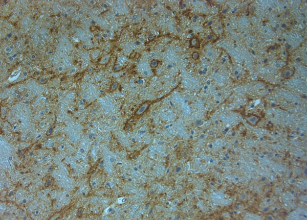 Aggrecan Antibody in Immunohistochemistry (Paraffin) (IHC (P))