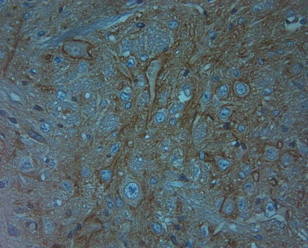 Aggrecan Antibody in Immunohistochemistry (Paraffin) (IHC (P))