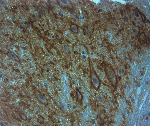 Aggrecan Antibody in Immunohistochemistry (Paraffin) (IHC (P))